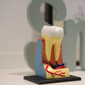 Effective Root Canal Treatment in Zurich: Pain Relief & Oral Health
