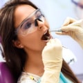 Endodontics in Woden: How A General Dentist Can Assist With Root Canal Treatment