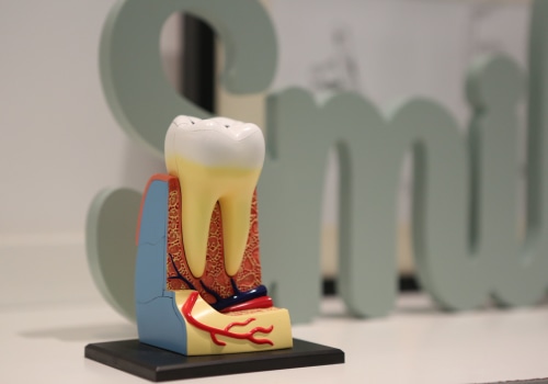 Effective Root Canal Treatment in Zurich: Pain Relief & Oral Health