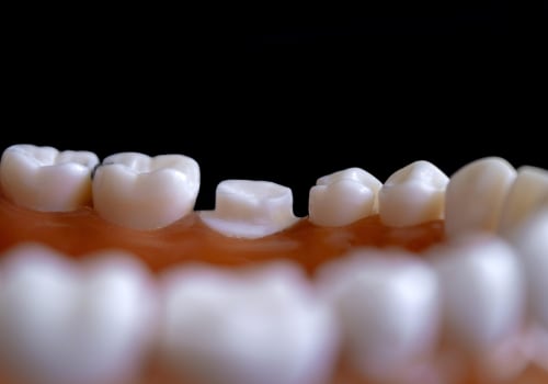 How Endodontics and Orthodontics Unite for Oral Health